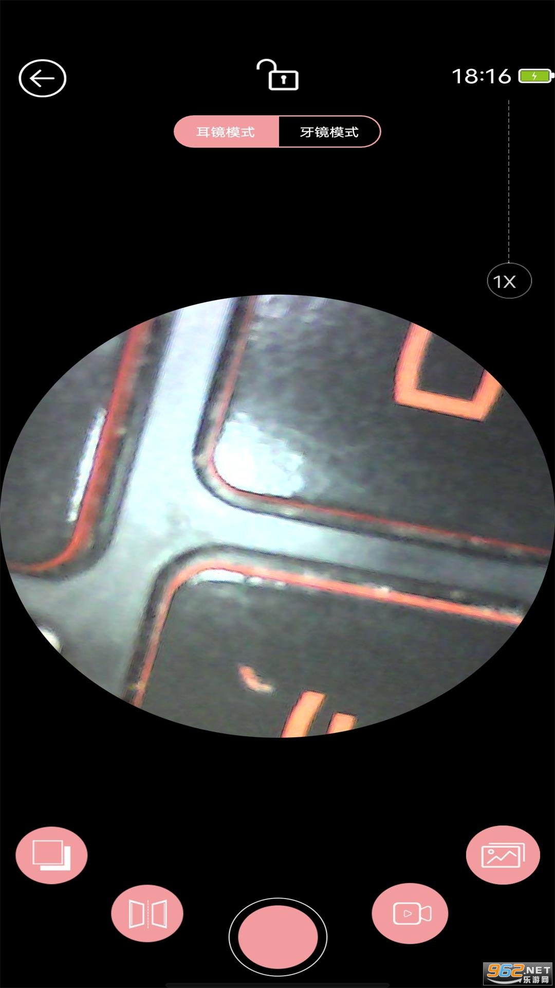 iTiMO耳镜appv7.6截图1